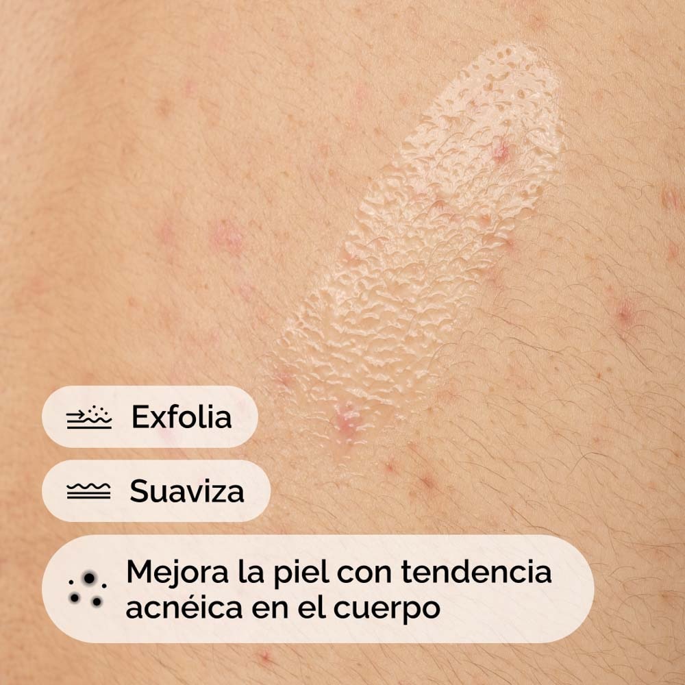 SALICYLIC ACID 0.5% BODY SERUM (SUERO CORPORAL EXFOLIANTE CON &Aacute;CIDO SALIC&Iacute;LICO)